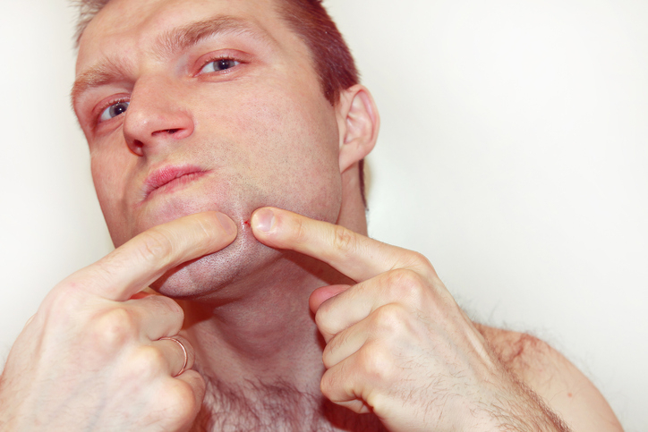 [남자 피부관리 tip] 피부 좋아지는 법과 하얘지는 법은? 오돌토돌 여드름 흉터 없애는 법까지