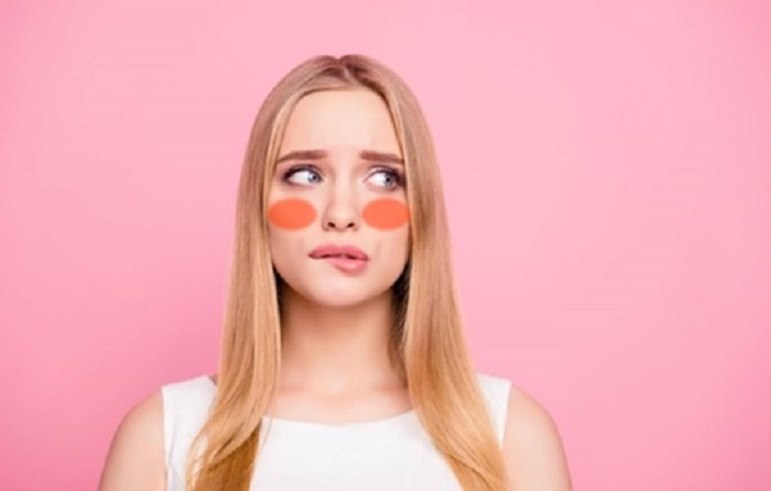 [지루피부염·안면홍조 A to Z] 안면홍조증의 원인은? 겨울 수분크림·보습크림 추천까지