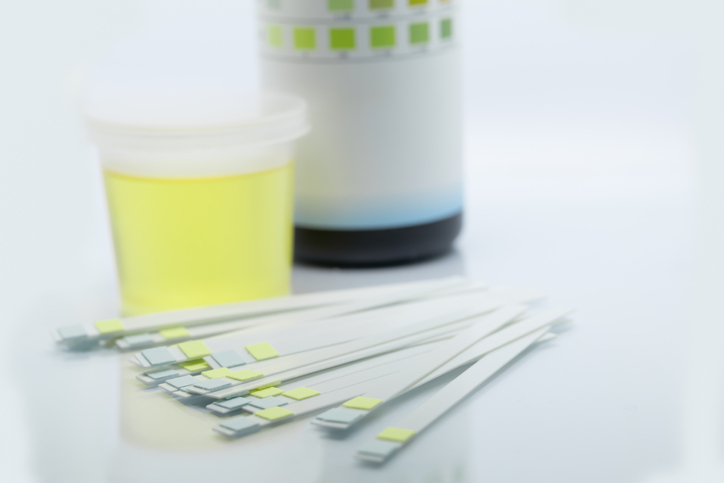 '소변에 거품'이 있다면 '단백뇨' 증상 의심, 단백뇨 원인과 치료방법을 알아보자