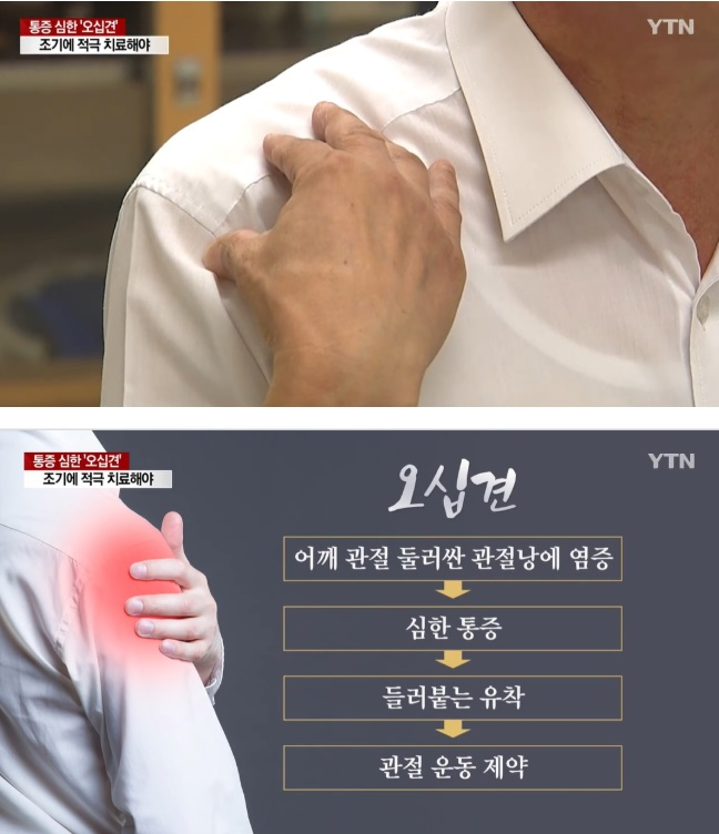 오십견, '옷 갈아입거나 샤워할 때 등 근력이 떨어지는 증상' 어깨통증 유발 원인 뭐길래?