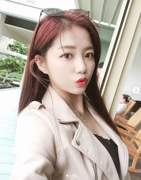 정다경, 송가인에게 '이것'까지 협찬받아? 원피스를 입었는데 발언 눈길